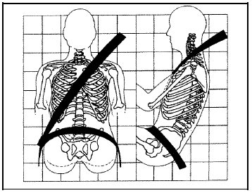 Occupants who are not buckled up can be thrown out of