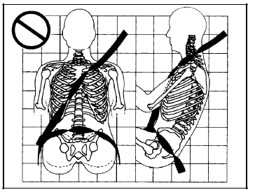 A: The belt is twisted across the body.