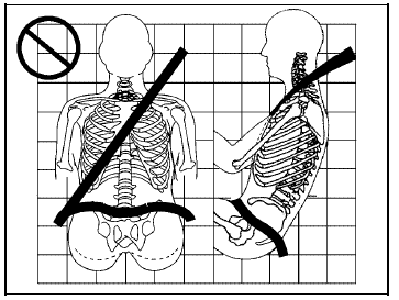 A: The lap belt is too loose. It will not give nearly as